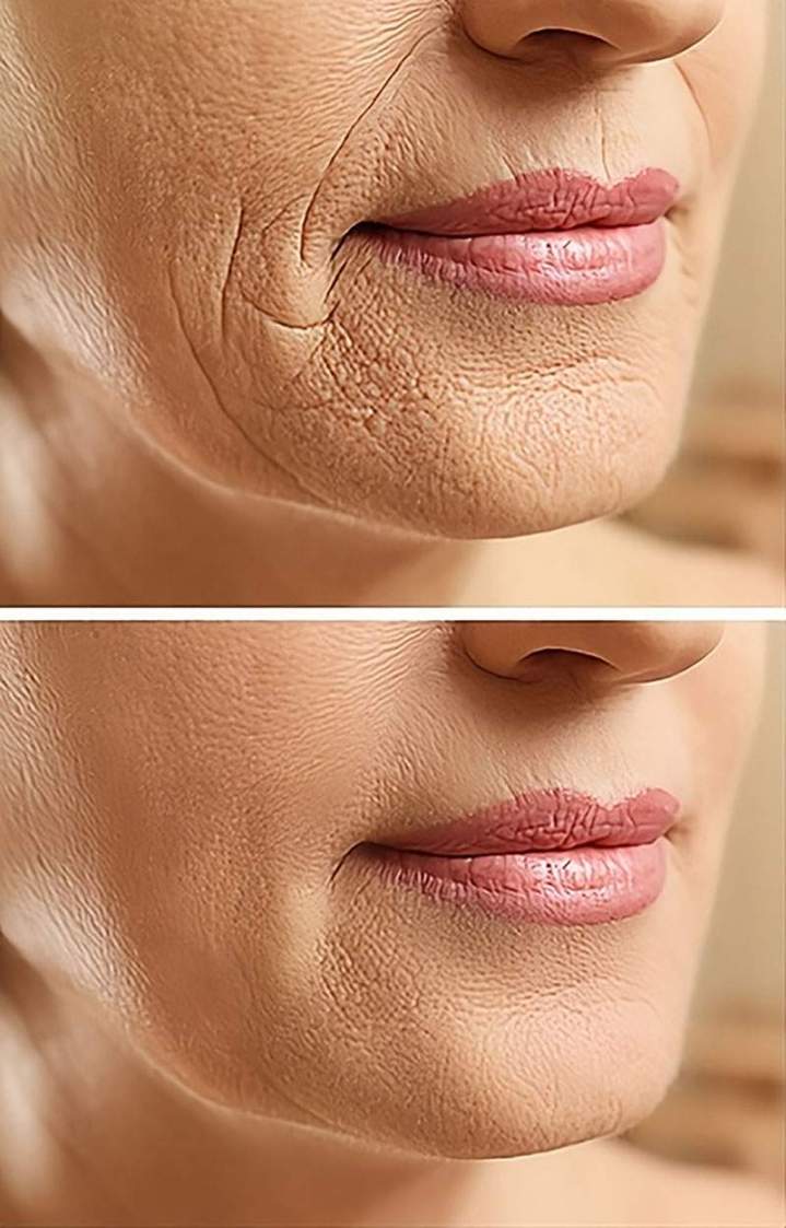 Soins anti-âge Saint-Just-en-Chaussée