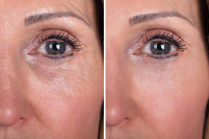 Soin du visage, Clermont